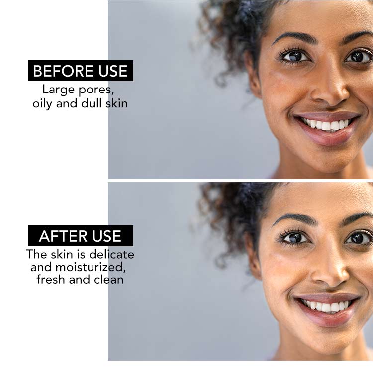 AILKE Whitening Remove Black Spots Facial Skin Care Lotion Moisturizing Cream Body Glutathion Vitamin C Black Skin Face New Set AILKE Whitening Remove Black Spots Facial Skin Care Lotion Moisturizing Cream Body Glutathion Vitamin C Black Skin Face New Set