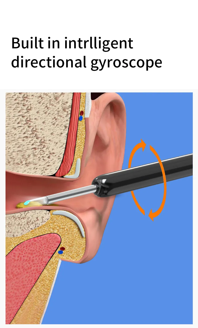 Smart Otoscope Ear Cleaner
